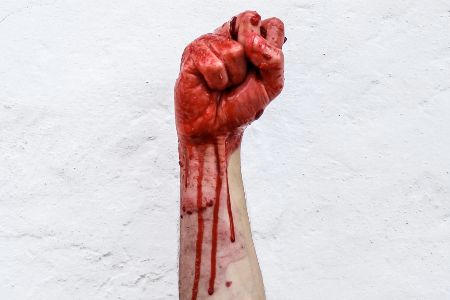 bloody fist